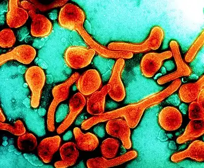 Transmission electron micrograph of Marburg virus particles  harvested from infected VERO E6 cell supernatant