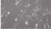Rhabdomyosarcoma cells.