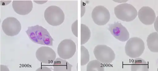 Giemsa-stained microscopy of Plasmodium ovale
