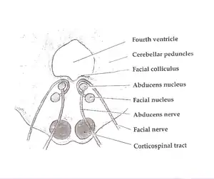 Axial section of the brainstem (pons) at the level of the facial colliculus