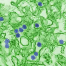 Electron micrograph of "Zika virus". Virus particles (digitally colored purple) are 40&nbsp;nm in diameter, with an outer envelope and a dense inner core.