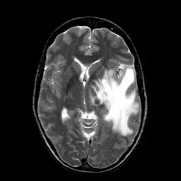 Brain Image