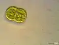 Actinotaenium globosum (35 × 18 µm)