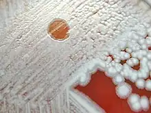 Lysehof von Bacillus-Phage Gamma bei Bacillus anthracis, rechts unbefallene Einzelkolonie