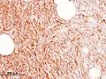 Immunhistologie: CD34