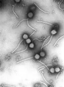 DNA-Viren: Bacillus-Phage Gamma (Klasse Caudo­viricetes, Morpho­typ Siphoviren)