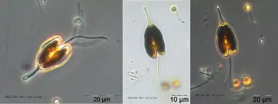 P. longicauda, Phasenkontrastmikroskopie (PCM).Susanne Busch, via SMHI