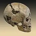 Schädel
