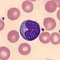 Lymphozyt