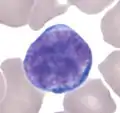 Lymphozyt