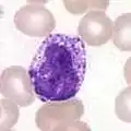 Basophiler Granulozyt